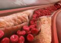 Продукти, які запобігають закупорку артерій