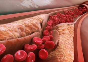 Продукти, які запобігають закупорку артерій